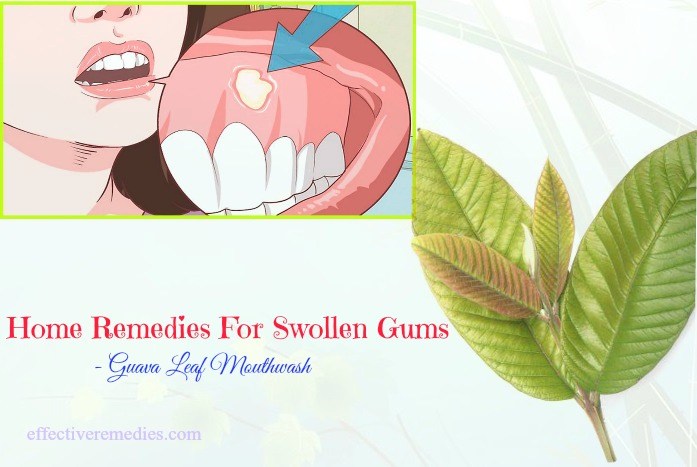 best home remedies for swollen gums - guava leaf mouthwash