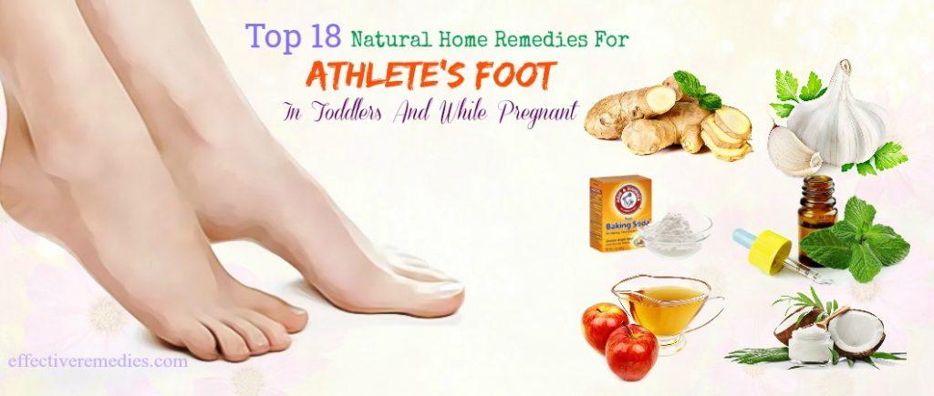 home remedies for athlete's foot while pregnant