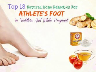 home remedies for athlete's foot while pregnant