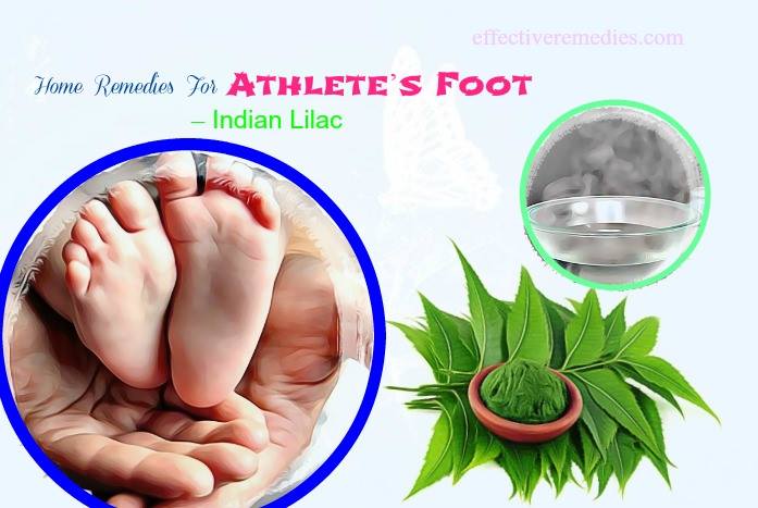 home remedies for athlete's foot - indian lilac