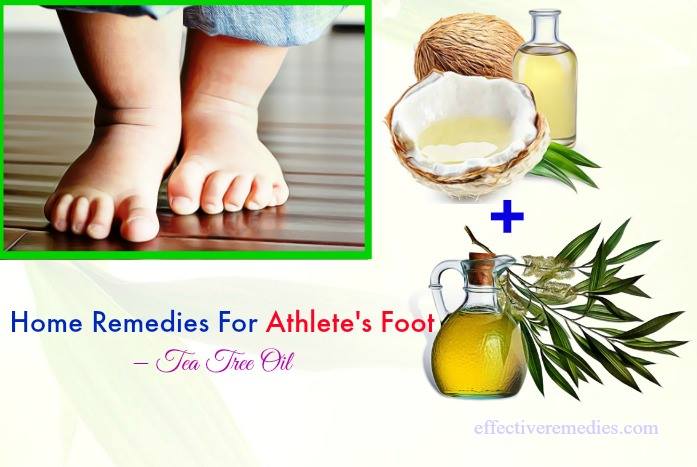 home remedies for athlete's foot - tea tree oil