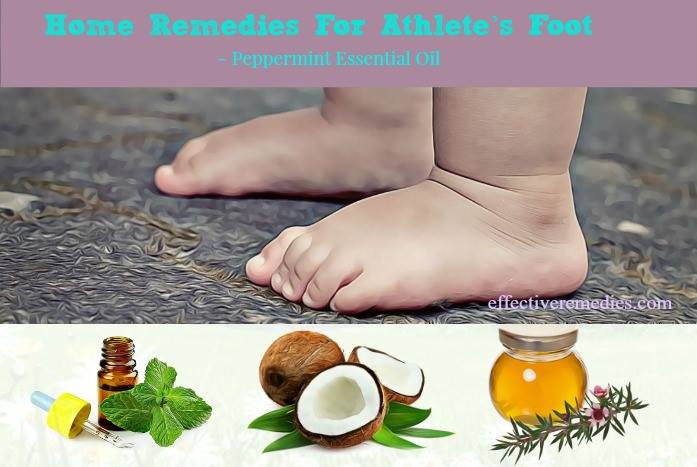 home remedies for athlete's foot - peppermint essential oil