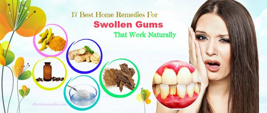 natural home remedies for swollen gums