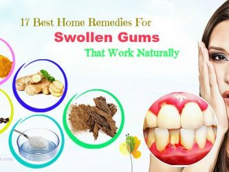 natural home remedies for swollen gums