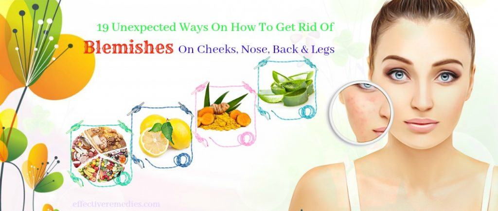 how to get rid of blemishes on cheeks