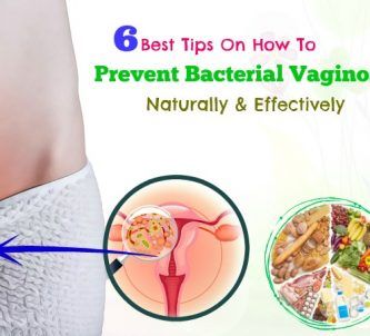 how to prevent bacterial vaginosis effectively