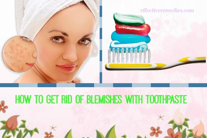 how to get rid of blemishes on back - toothpaste