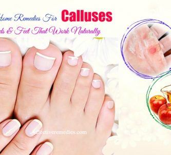 effective home remedies for calluses