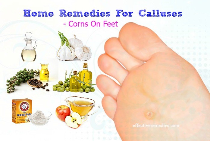 calluses & corns on feet