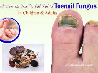 how to get rid of toenail fungus in children