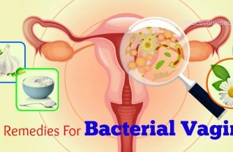 natural home remedies for bacterial vaginosis