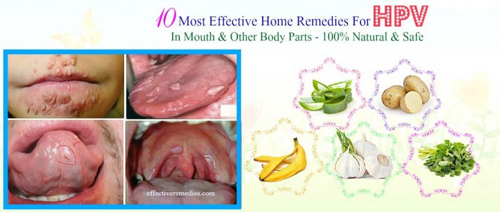 effective home remedies for hpv