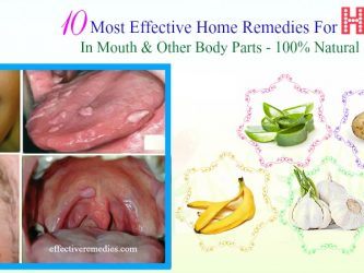 effective home remedies for hpv