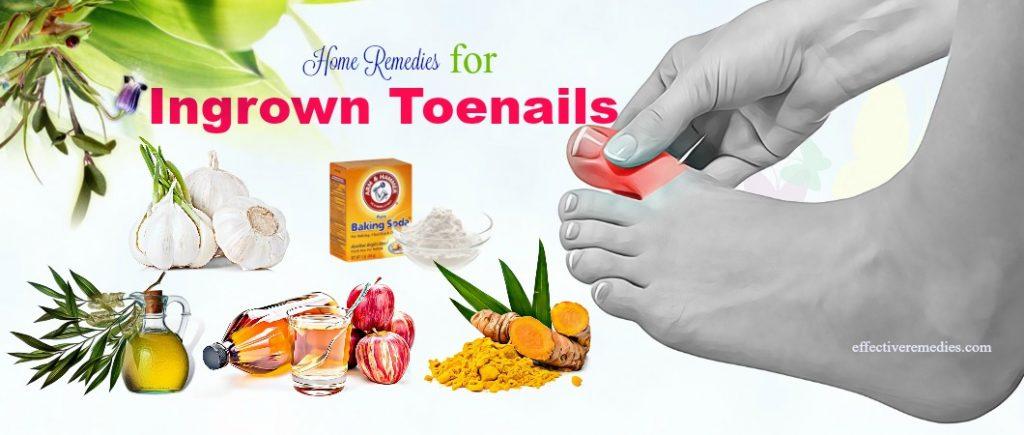 home remedies for ingrown toenails infection