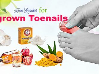 home remedies for ingrown toenails infection