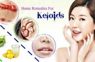 effective home remedies for keloids