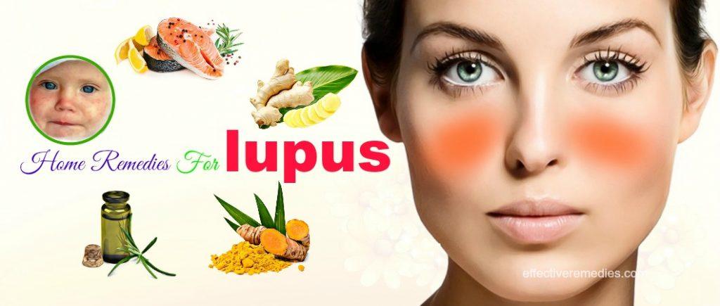 effective home remedies for lupus