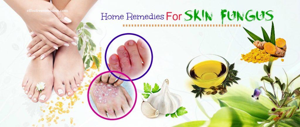 effective home remedies for skin fungus