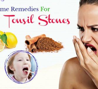 home remedies for tonsil stones and bad breath