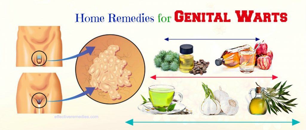 home remedies for genital warts in males