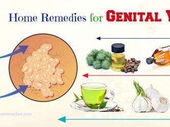 home remedies for genital warts in males