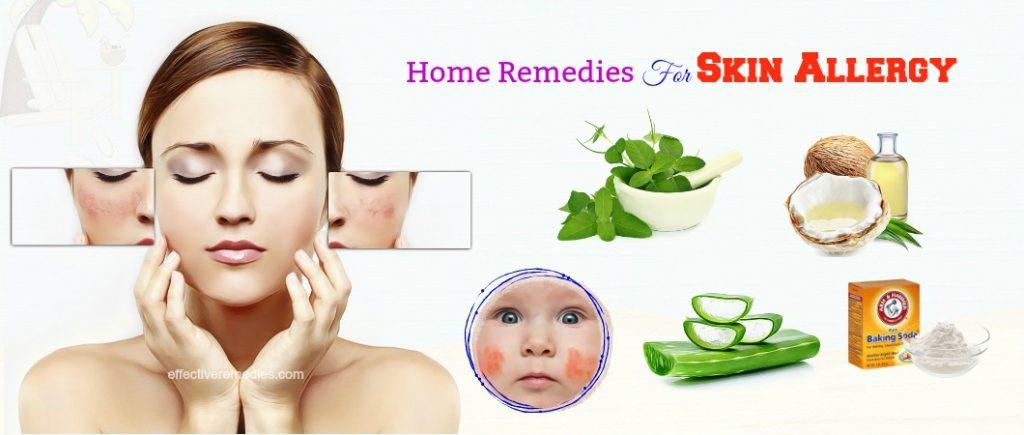 effective home remedies for skin allergy