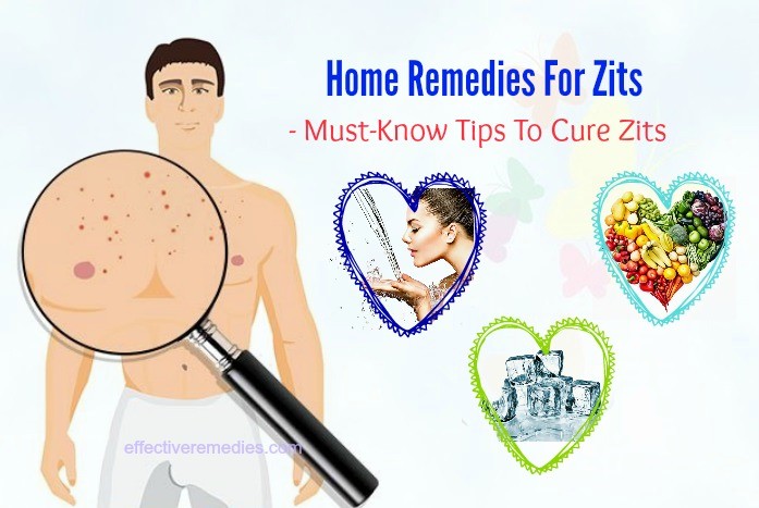 must-know tips to cure zits