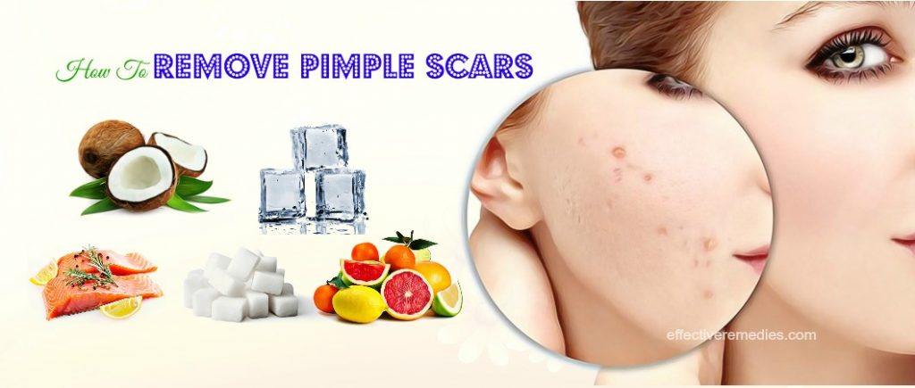 how to remove pimple scars from face