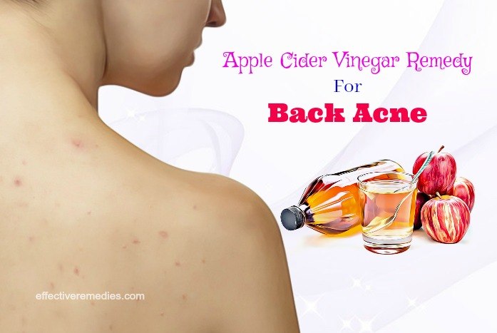 apple cider vinegar 