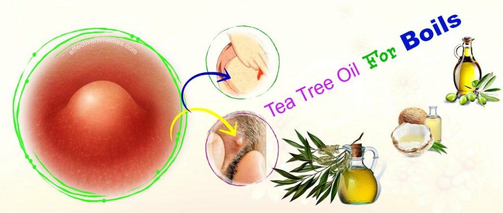 tea tree oil for boils on inner thighs