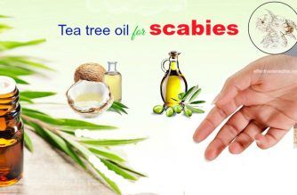 tea tree oil for scabies in kids