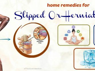 effective home remedies for slipped or herniated disc