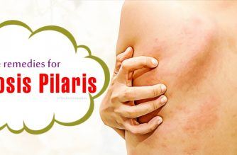 home remedies for keratosis pilaris on face