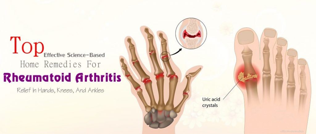 home remedies for rheumatoid arthritis relief in hands, fingers, knees, ankles