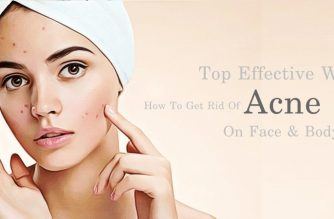 how to get rid of acne spots on face & body