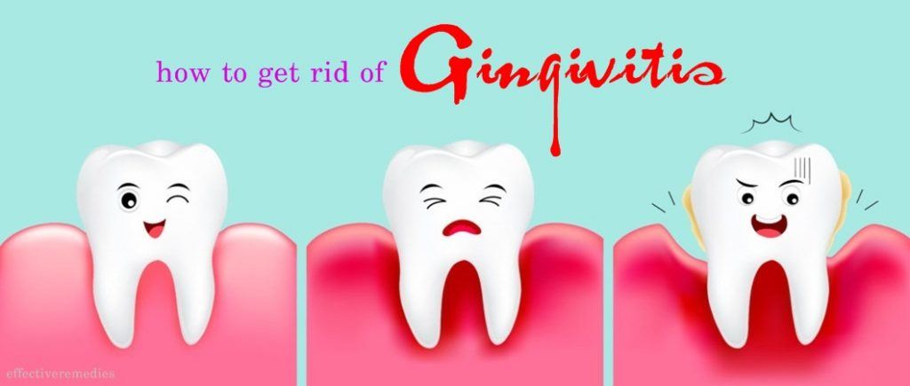 how to get rid of gingivitis in children