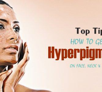 how to get rid of hyperpigmentation on face