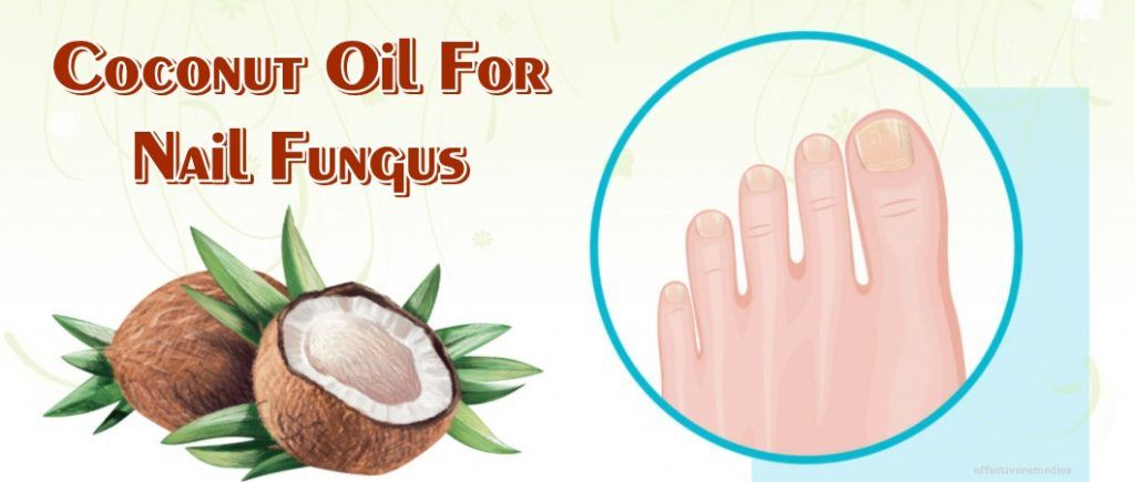 how to use coconut oil for nail fungus